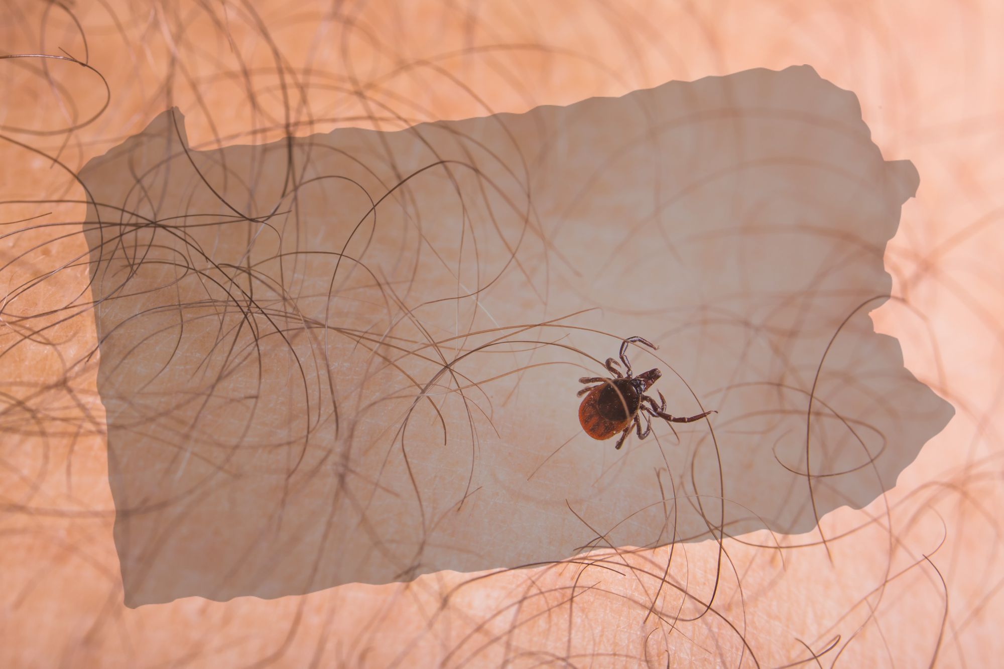 Are You Ready for Pennsylvania's Tick Explosion?